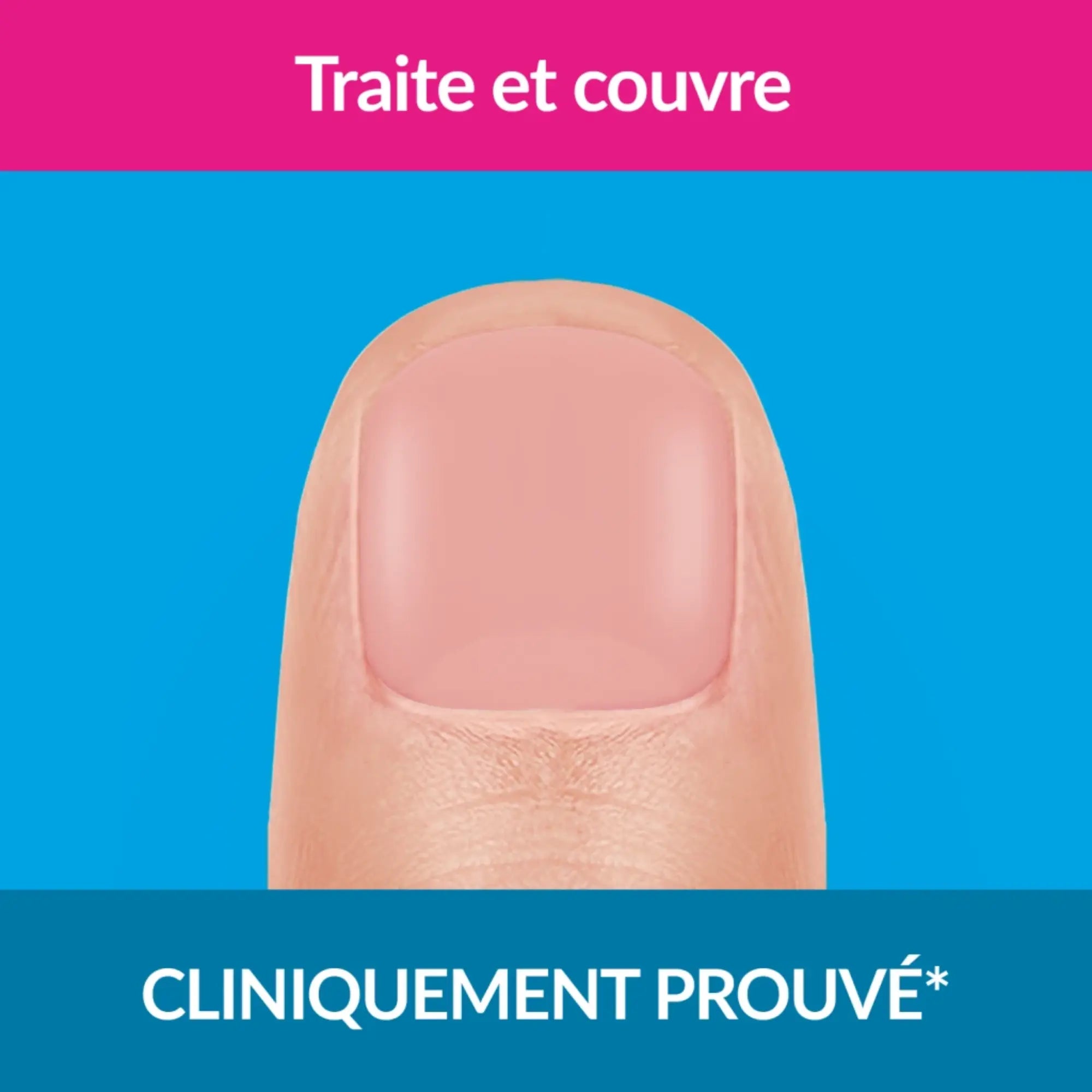 Traitement mycose ongles forte couleur nude 30ml - Excilor Excilor 